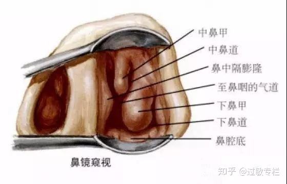成都耳鼻喉医院鼻甲肥大有哪些症状??